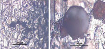 Figure 7. Photomicrographs of small burned holes on the surface filter core (200x and 1,000x magnification) Figure 7. Photomicrographs of small burned holes on the surface filter core (200x and 1,000x magnification)