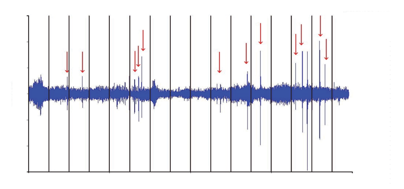 Figure 8. Impacting and looseness in the vibration signature Figure 8. Impacting and looseness in the vibration signature