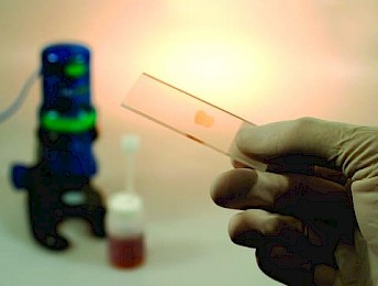 Optical particle analysis